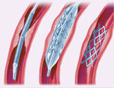 Medical industry